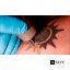 YouTube видео How Laser Tattoo Removal Works - Smarter Every Day 123. #Plastic Surgery